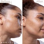 Stylpro 2-in-1 Sonic Dermaplane